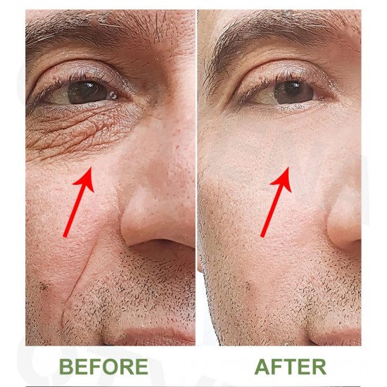 NEW!! OTVENA Skin Rapid Lifting Firming Eye Vegan Cruelty-Free 12ml Facial Serum