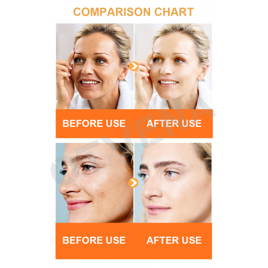 Best Anti aging cream 15 Years Factory Low MOQ Private label 5 sec removal wrinkles cream 